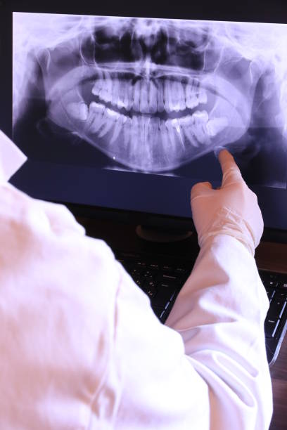 Best Emergency Root Canal Therapy in Sun City West, AZ